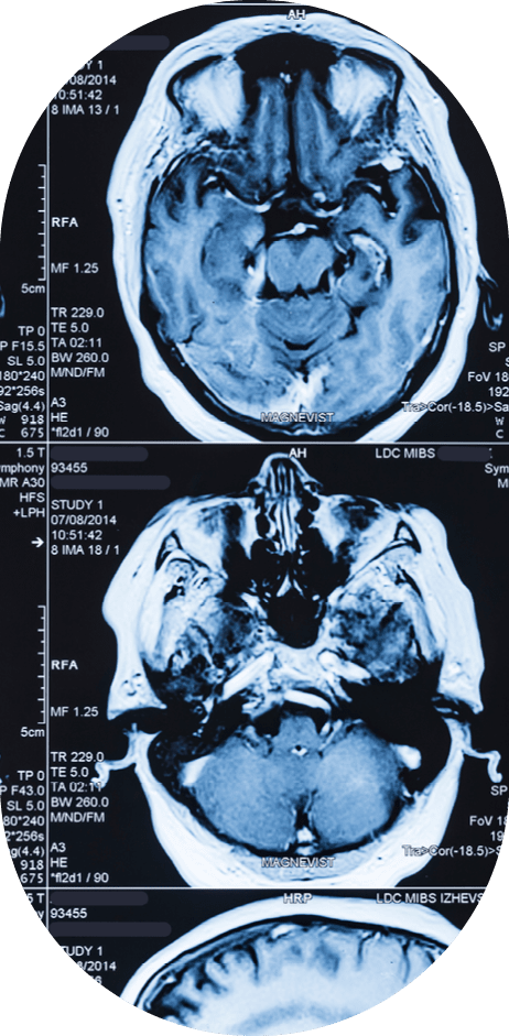 Magnetic resonance imaging (MRI) scans of the human brain.