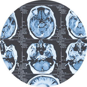 Magnetic resonance imaging (MRI) scans of the human brain.