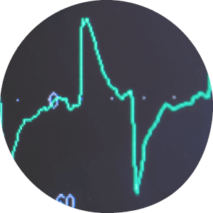 Ventilation of the lungs with oxygen. COVID-19 and coronavirus identification. Pneumonia diagnosting. Pandemic.